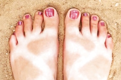 Skin Cancer Prevention Month: Is Sunscreen Actually Effective in Preventing Skin Cancer?