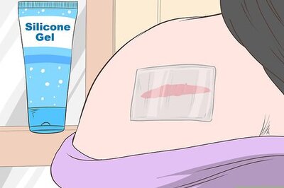 How to Heal Hypertrophic Scars