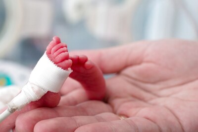 Covid-19 During Pregnancy Can Increase The Risk of  Premature Birth By 60 Percent, Says Study