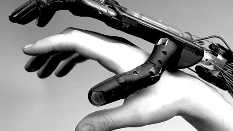 World's first fully bionic man walks, talks and breathes