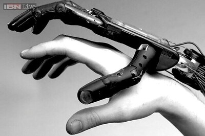 World's first fully bionic man walks, talks and breathes