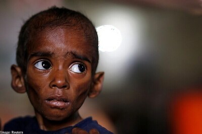 Malnourished kids to get higher dietary intake in India