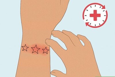 What to Do If You Scratch Your New Tattoo