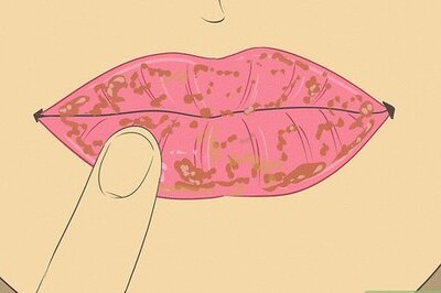 How to Get Rid of Flaky Lips With Petroleum Jelly