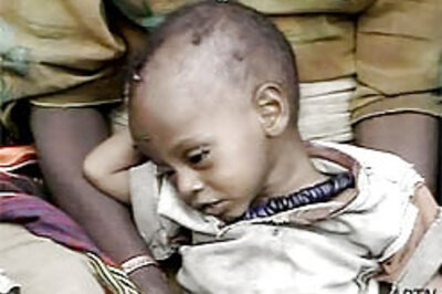 Poor nations' health concerns UN