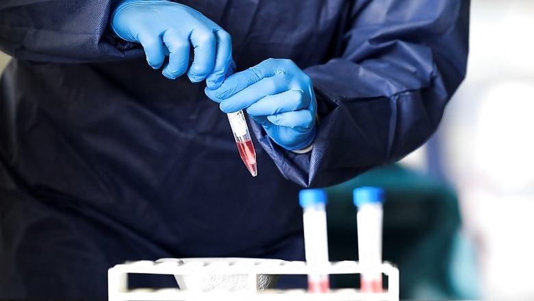 In Bid to Combat Covid-19, Clinical Trial of Plasma Therapy to Begin in Kolkata