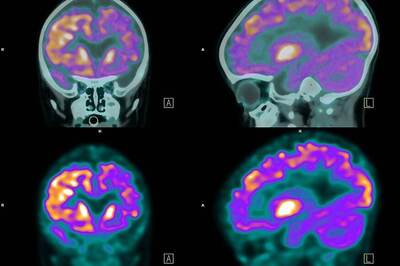Study Links Creativity to Left And Right Brain Connections