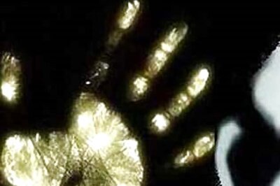 PG medical student commits suicide over fee hike