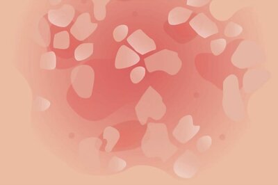 Psoriasis in India: Unraveling the Gender Disparity and Its Impact on Men's Health