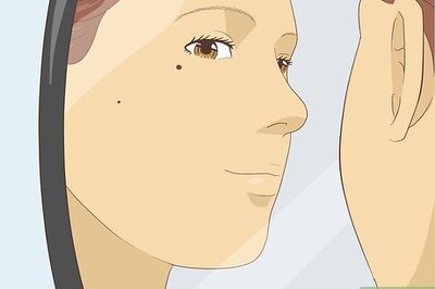 How to Get Rid of Moles on Your Face