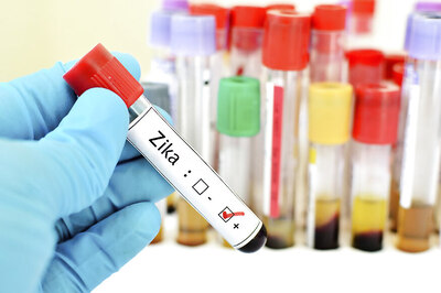 New Study Says Women Travelers Are More Aware of Zika Risks