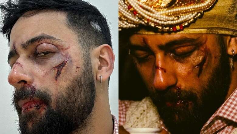 AFKAP Breaks Down His Latest EP Parat: 'Experiences Shouldn't Be Judged With A Binary Lens' | Exclusive