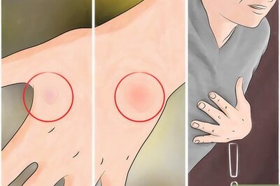 How to Treat Yourself if You Get Stung by a Bee or Wasp