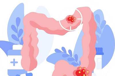 Appendix Cancer in Different Demographics: Are Certain Groups More at Risk?
