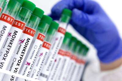 Can Monkeypox Be Treated? UK Study Says Antivirals Might Shorten Symptoms, Time Patient is Contagious