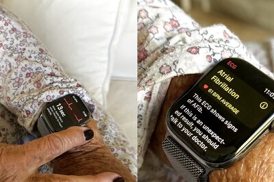 Apple Watch Detects Grandmother's Irregular Heartbeat Just in Time, Saves Her Life