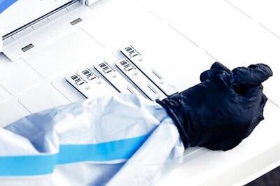 Tests: 2.5% of Italians had COVID-19, far more in the north