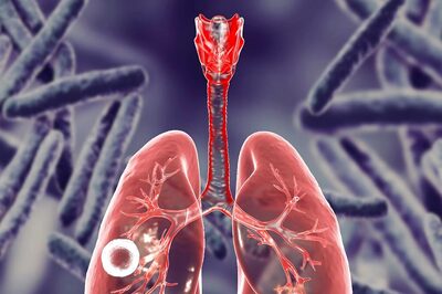 World Tuberculosis Day 2023: Theme, History and Significance