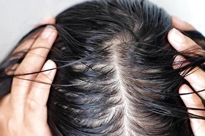 Not Just Skin, Sea Salt Can Make Even Your Hair Better