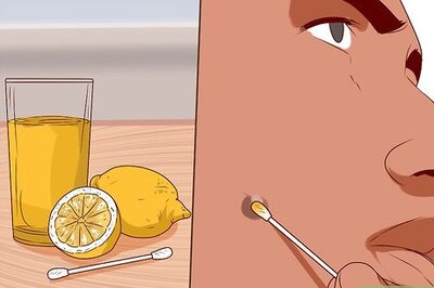 How to Get Rid of Ingrown Hair Scars