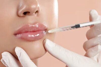 How Long Does Botox Last? Know From An Expert
