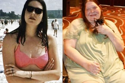 Snapshot: The woman who wouldn't stop growing