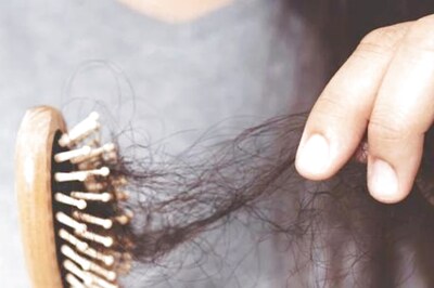 Being Sick for a Long Time Affects Your Hair Quality. Know How To Nurture Them
