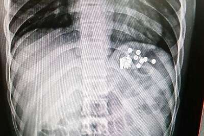 Thief Swallows Stolen Mangalsutra, MP Cops Recover It From Inside His Belly