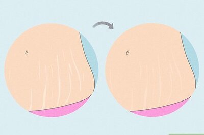 14 Ways to Use Bio-Oil