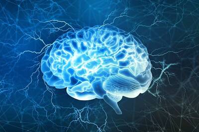 Aerobics May Protect Against Alzheimer's Disease