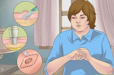 How to Heal from a Skin Biopsy