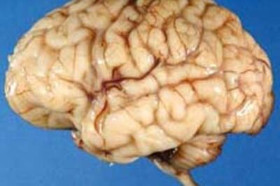 How does our brain choose the right words?