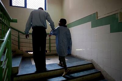 Testing Human Hair could One Day Help Detect Schizophrenia, Say Scientists