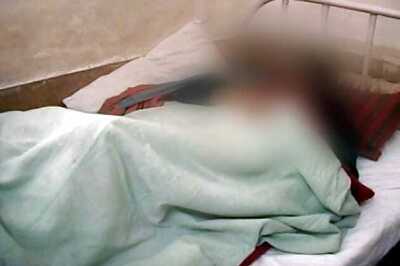 J&K govt to bear expenses of acid attack victim's treatment