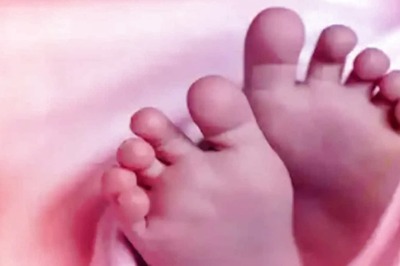 Mother Gives Birth to Conjoined Twins in Bihar's Bhagalpur Hospital
