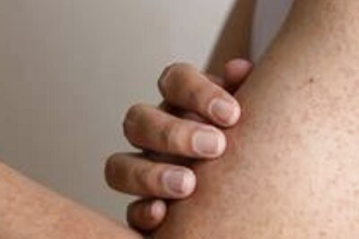 Keratosis Pilaris: Follow These Tips To Get Rid Of Chicken Skin This Winter