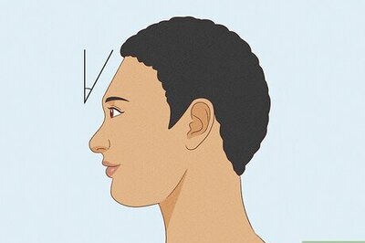 Do You Have a Sloped Forehead? Here’s Why & What it Means