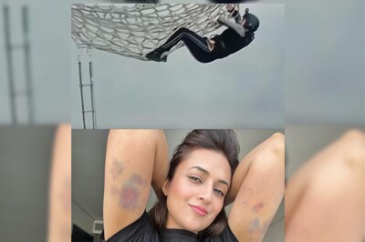 Khatron Ke Khiladi 13: Divyanka Tripathi's Bruises Show Her Undying Spirit