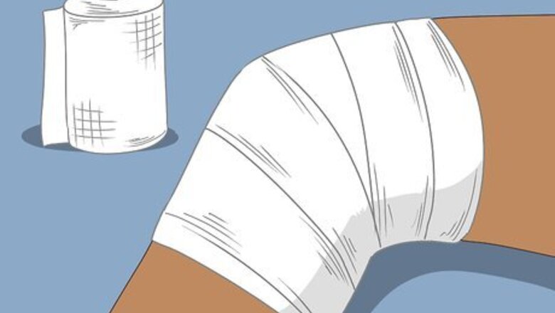 How to Heal After ACL Surgery