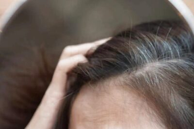 Are You Having Nightmares of Grey Hair? Tips to Prevent Premature Greying