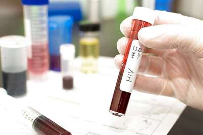 World AIDS Day: Five Facts About the Deadly Disease