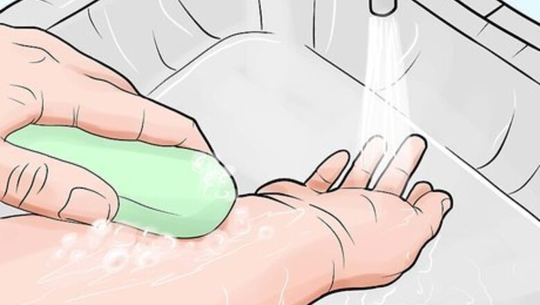 How to Heal Mosquito Bites