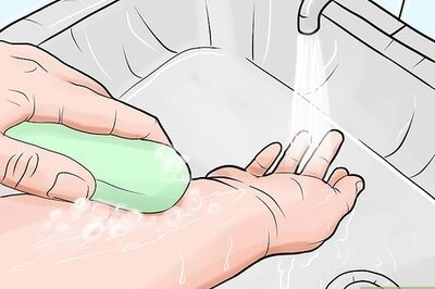 How to Heal Mosquito Bites