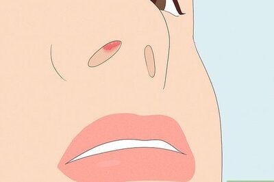 A Complete Medical Guide to Cold Sores on the Nose (with Pictures)