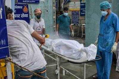 Mucormycosis Kills 303 in Karnataka Who Had Fully Recovered from Covid-19, 34% Deaths in Bengaluru