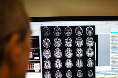 New Alzheimer's Drug Deemed Too Costly for UK's State-run Health Service