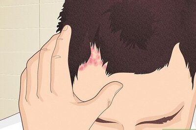 Identifying and Caring For Bumps on the Scalp