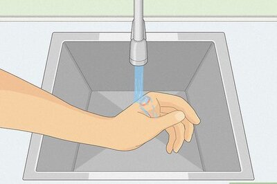 How to Treat a Small Burn