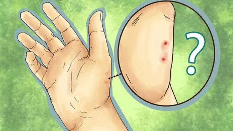 How to Treat Snake Bites in the Wilderness