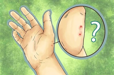 How to Treat Snake Bites in the Wilderness